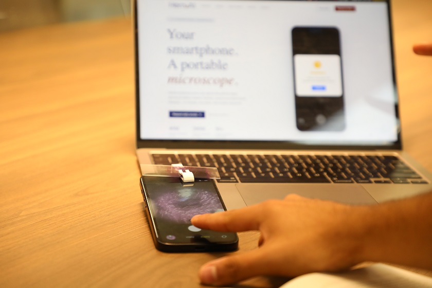 Startup transforma smartphones en microscopios clínicos que detectan enfermedades en pocos minutos